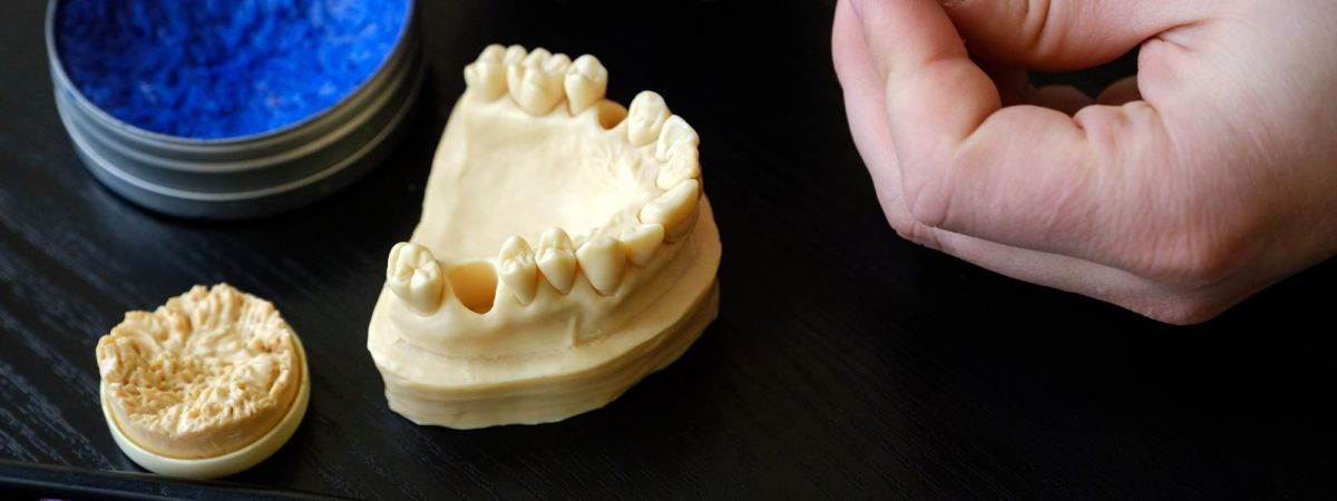 Wie werden Zahnimplantate hergestellt